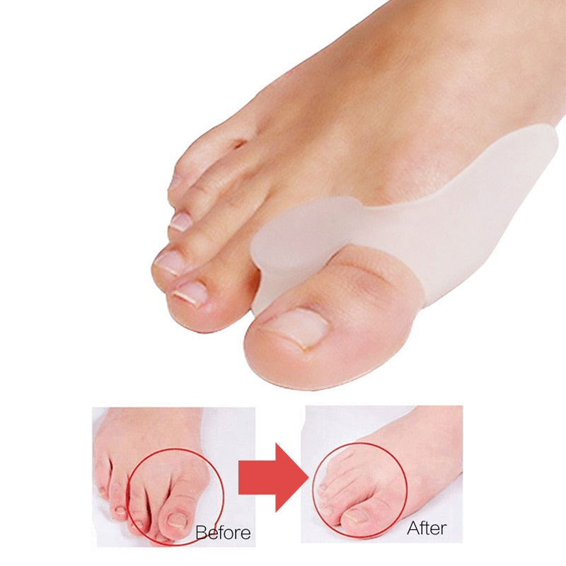 2Pcs Bunion Corrector Set