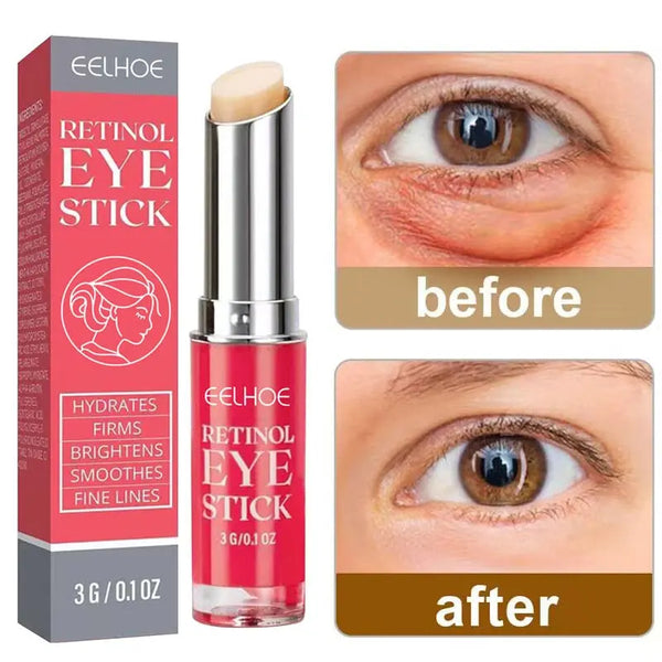 Retinol Eye Cream Stick