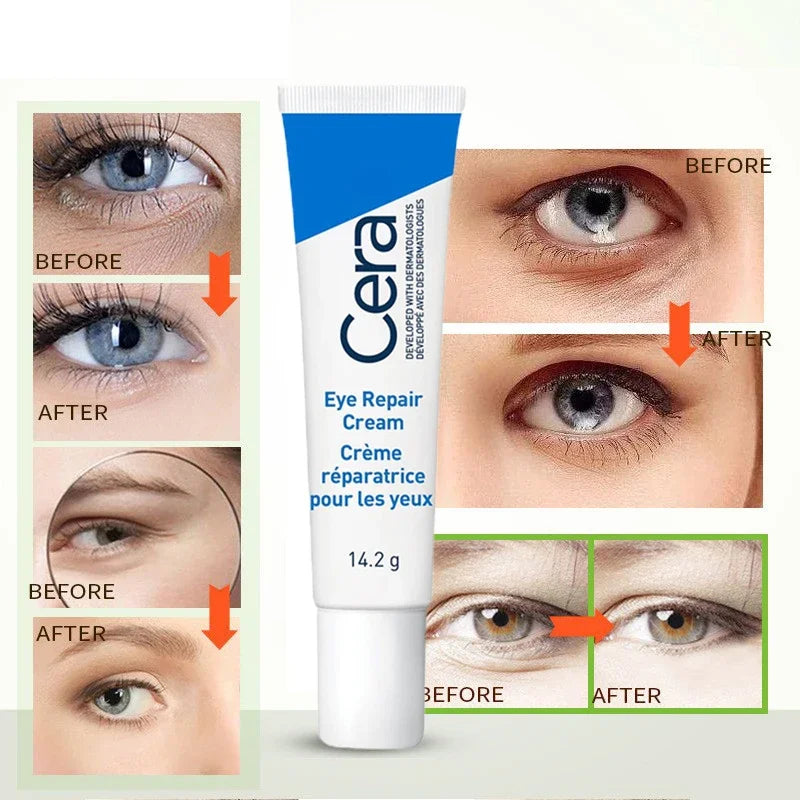 Eye Beauty Health